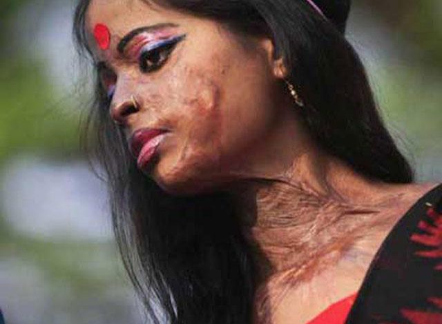 ألغت صداقته على فيسبوك.. فأحرقها