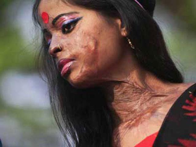 ألغت صداقته على فيسبوك.. فأحرقها