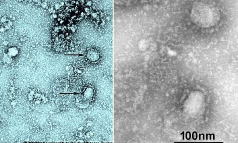 أول صورة لفيروس كورونا استخرجوه من أحد ضحاياه بالصين