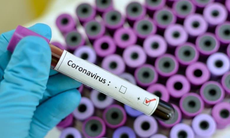 لبنان يسجل إصابات جديدة بكورونا.. والعدد يرتفع إلى 28