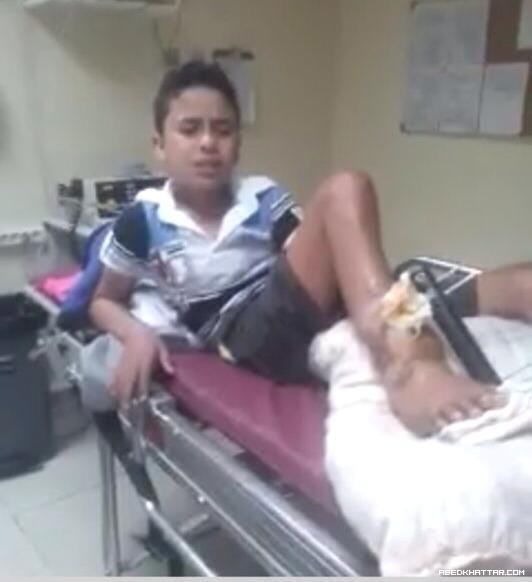 قصة الطفل مصطفى شتيوي ... وجع وألم وانتظار لأصحاب الضمائر الحية