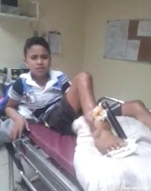 قصة الطفل مصطفى شتيوي ... وجع وألم وانتظار لأصحاب الضمائر الحية