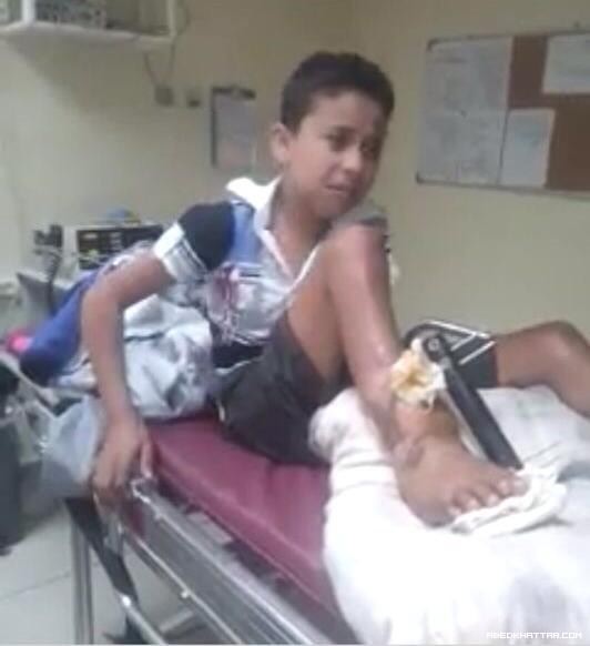 قصة الطفل مصطفى شتيوي ... وجع وألم وانتظار لأصحاب الضمائر الحية